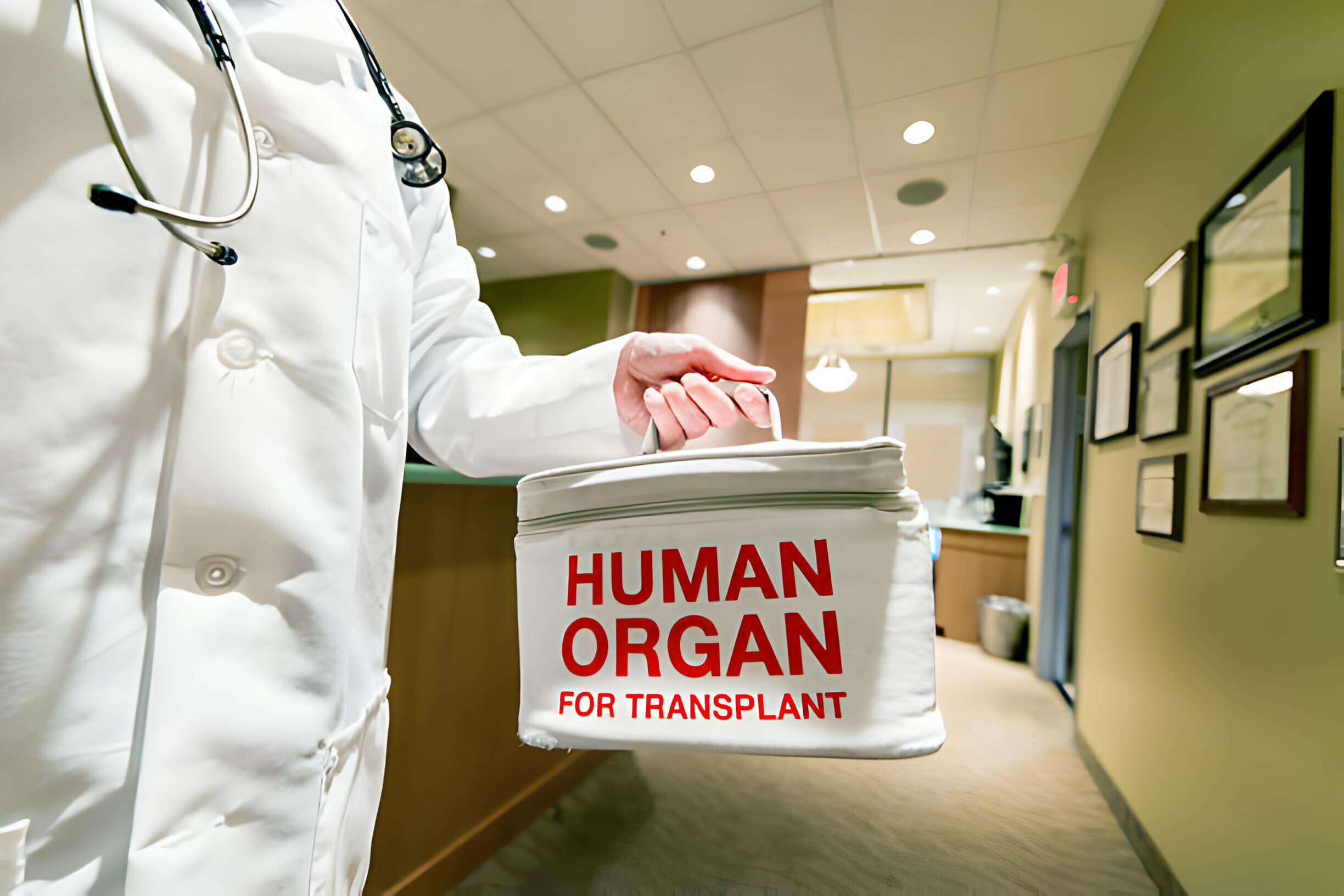 Organ and Tissue Transplant | African Medical Services